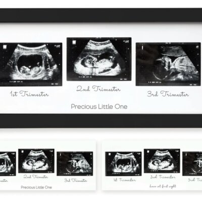 Trio Baby Sonogram Frame